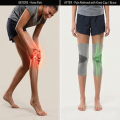 Xenric Orthopedic Knee Cap | Compression Knee Support